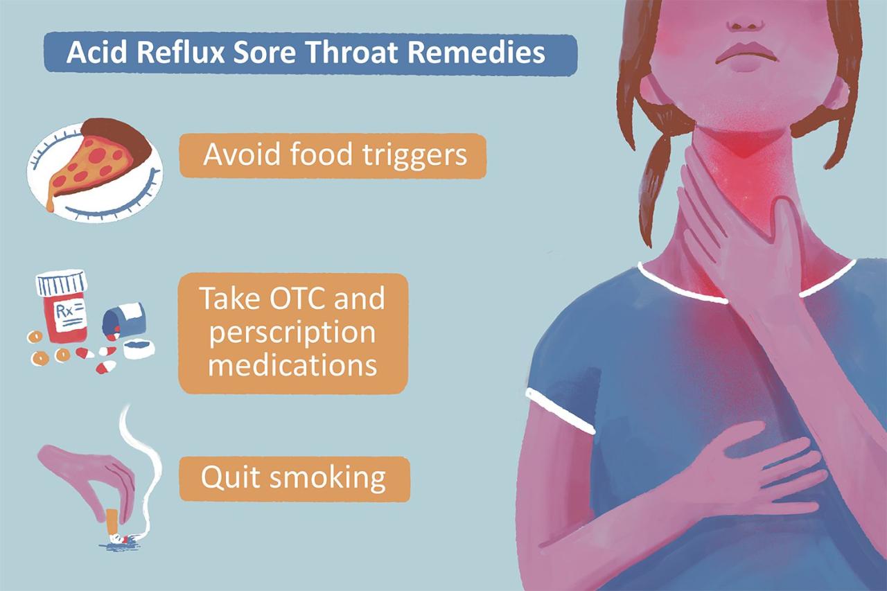 Acid Reflux Sore Throat Remedies: Habits & Medicines